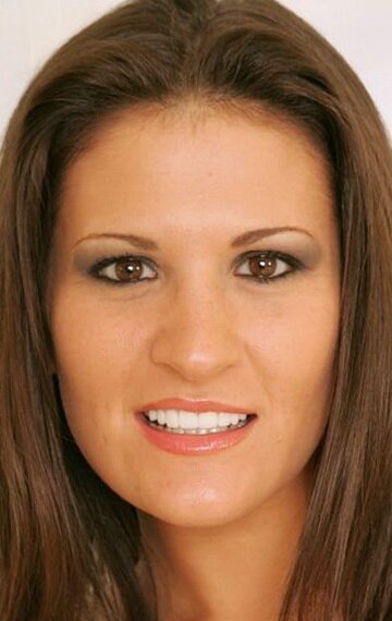 фото Остин Кинкейд