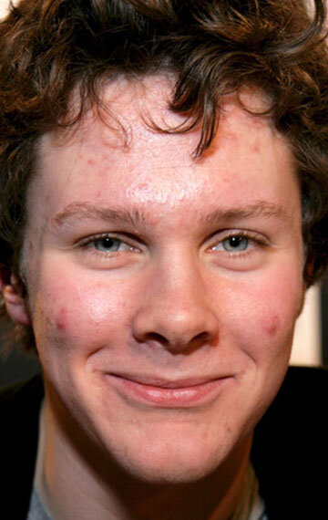 фото Олли Барбьери