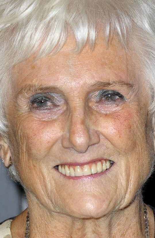 фото Берил Верту