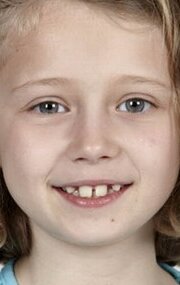 фото Иона Уорн