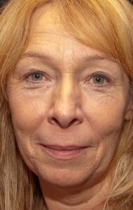 фото Уилл Копман