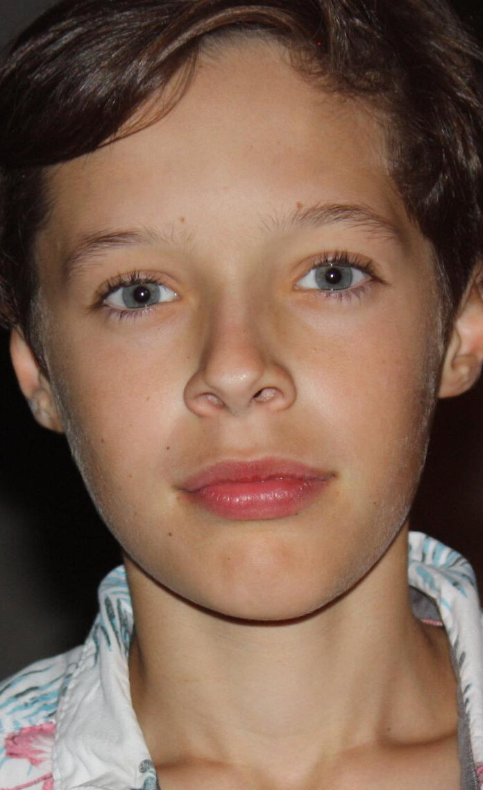 фото Оуэн Брюммер