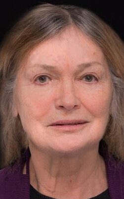 фото Кари Онстэд Винги