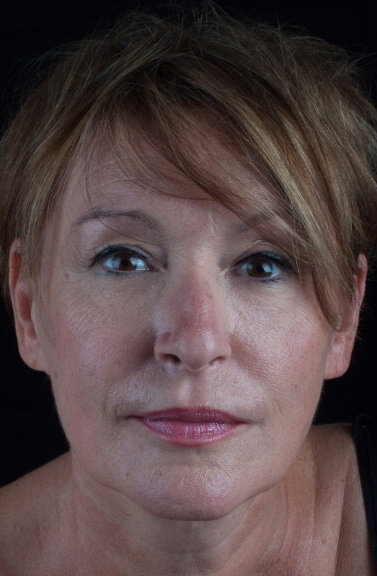 фото Николетта Мараньо