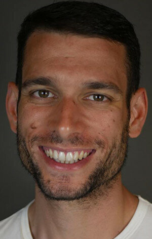 фото Энтони Муассе