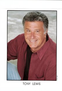 фото Тони Льюис